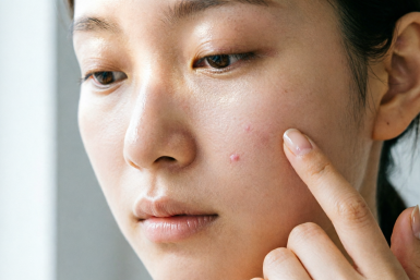 Мешаю 1:1 и наношу на прыщ точечно — утром испарится без следа, не останется даже красноты