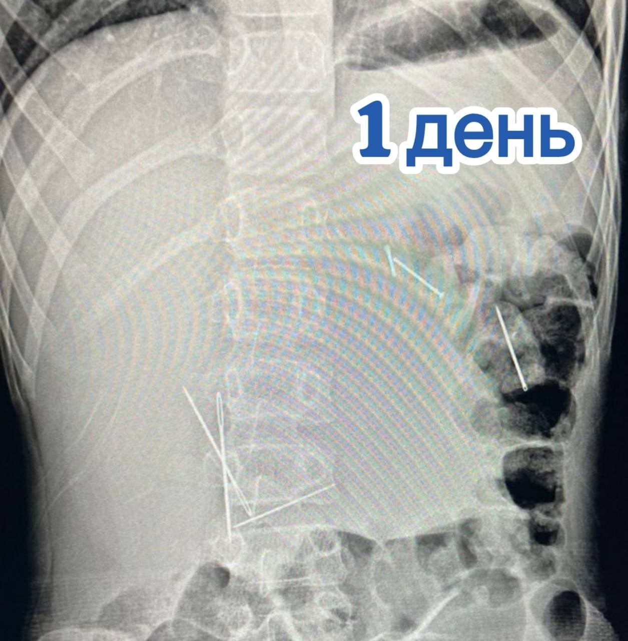 Телеграм-канал Клиники доктора Рошаля